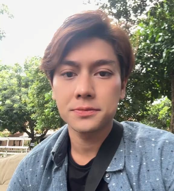 Rizky Billar Pasang Behel, Akui Tersiksa Tak Bisa Makan Sate Kambing